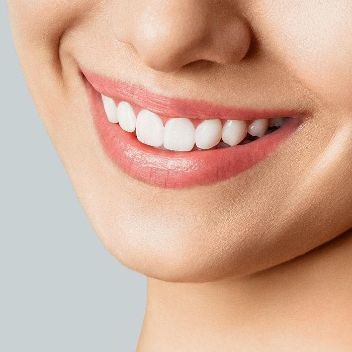 אזור אסתטי – שיניים קדמיות