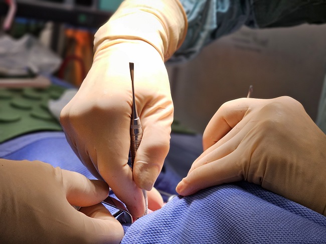 טיפול ב GUMMY SMILE